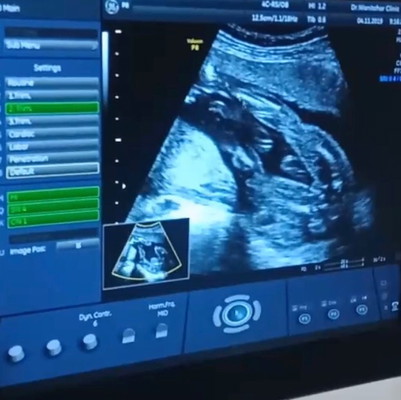 ได้ลูกสาวค่ะ