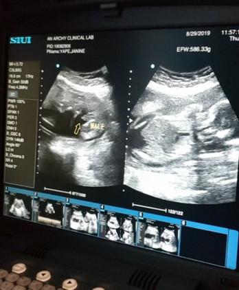 Baby Boy! ?