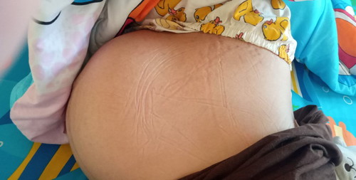ตอนนี้ท้องได้38วิก2วันแล้วค่ะ