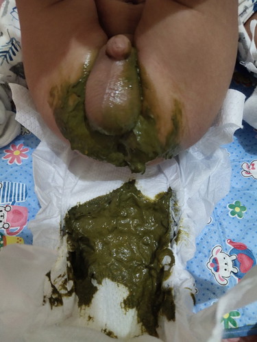 Normal po ba green poop pure formula?