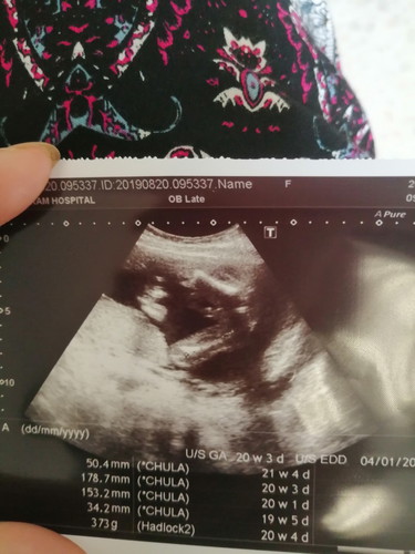 แม่ช่วยดูเพืีอยืนยันหน่อยค่ะ