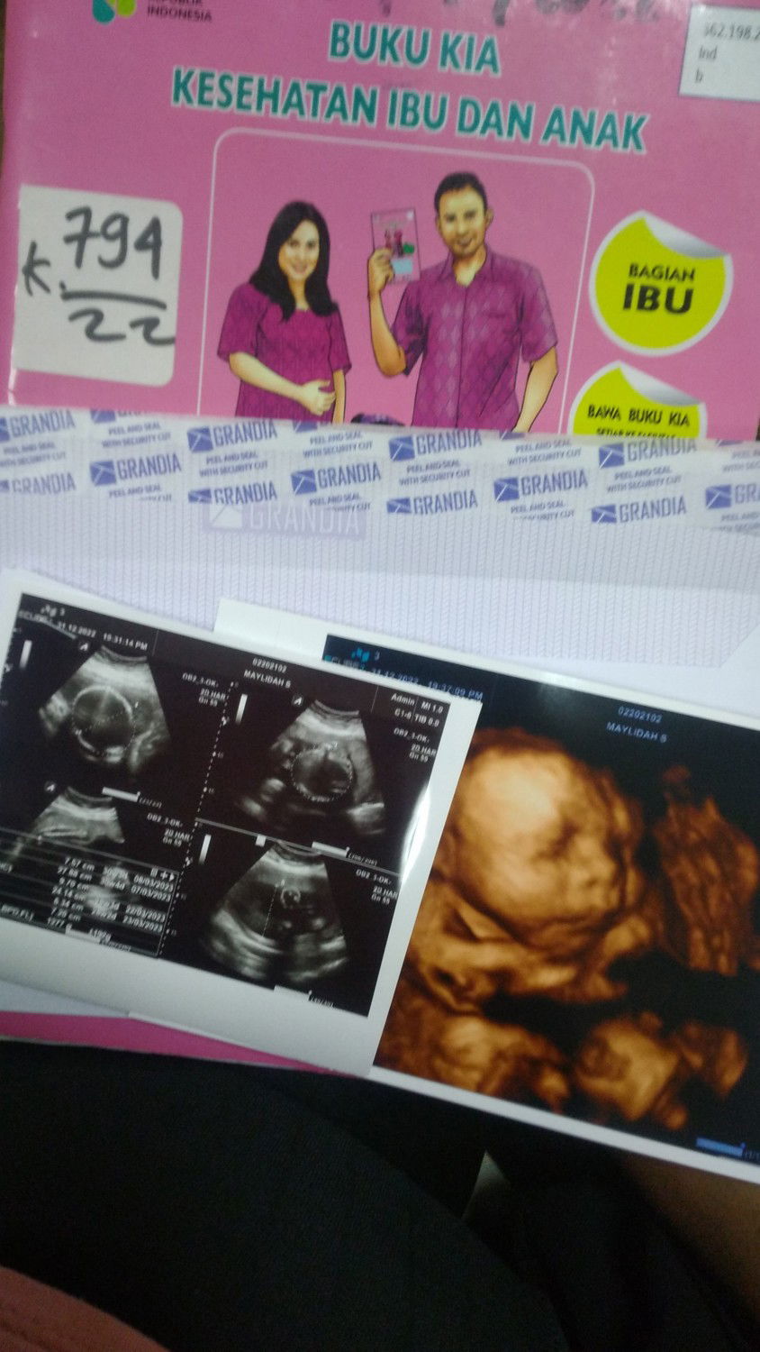 Meyy Lind profile icon