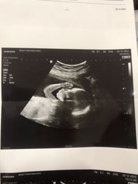 Toey Anutsara profile icon