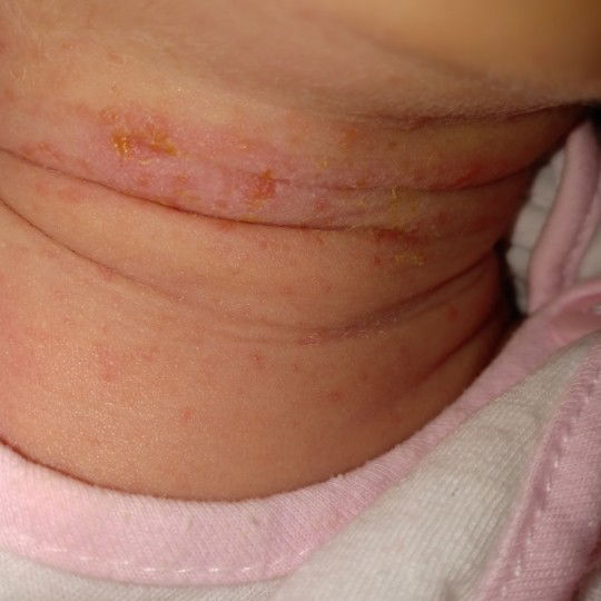 thương e quá.m nao co con bi ntn chua.