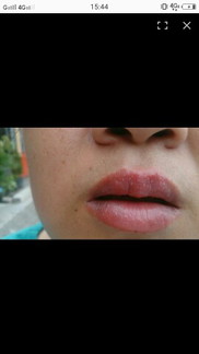 เคยเป็นกันไหมค่ะ