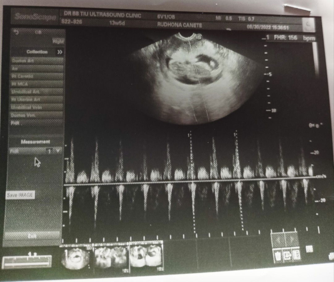 Dhona Oroja Canete profile icon