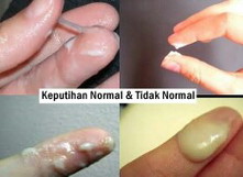 keputihan