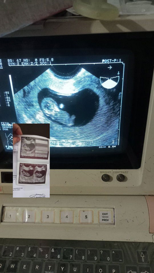 Marygrace bilad profile icon