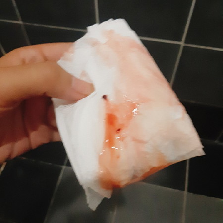 เลือดออกอีกแล้วคะ