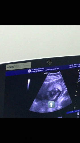 ได้ลูกชายอีกแล้วว