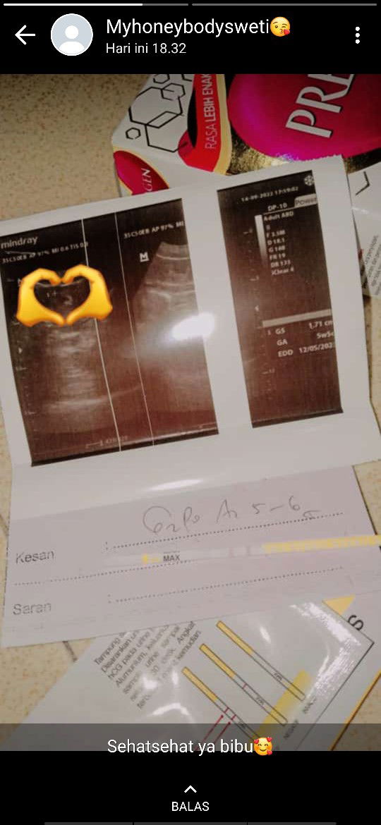 Bunga Fortuna profile icon