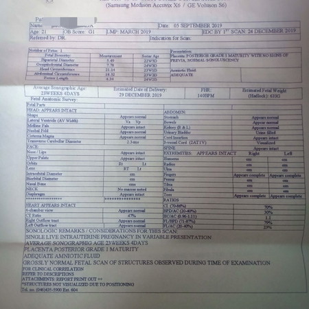 CAS Result