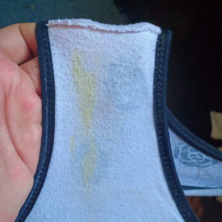 Im 35 weeks preggy po. And pag gising ko po ngayon lang eto po nakita ko. Normal lang po ba yung ganitong discharge?