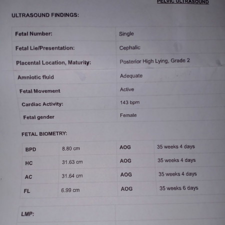 Ultrasound Result
