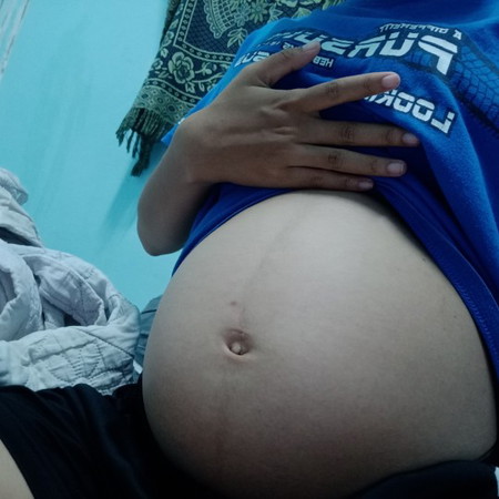 ยังไม่รู้เพศน้องเลยจ้า26สัปดาห์แล้ว