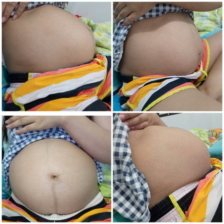 คนทักว่าท้องเล็ก ท้อง 7 เดือน