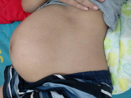 36 week 5 d