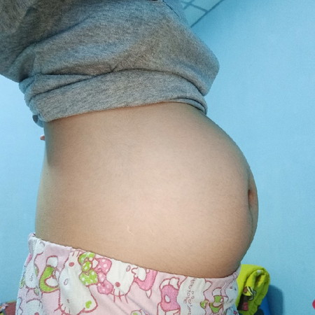 17สัปดาห์ท้องเล็กมากไปไหมค่ะ แล้วแบบนี้จะได้ผู้หญิงหรือผู้ชายกันค่ะ