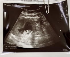 ฐานิดา แสนเมือง profile icon