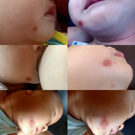 เป็นโครร้ายแรงรึป่าวค่ะ