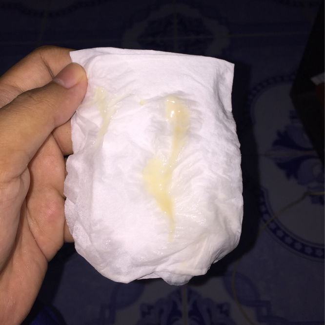 Keluar lendir tapi confius