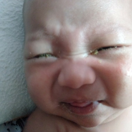 น้องตาแฉะ