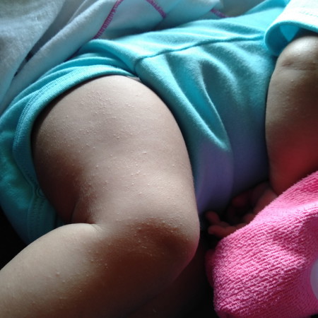 พดร้อนใช่ไหม