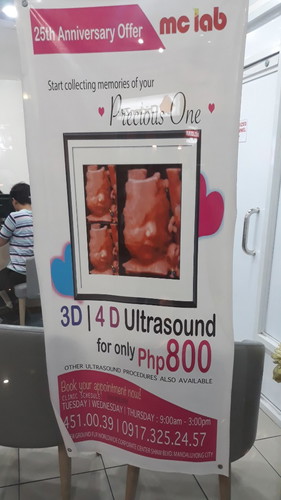 Affordable 3d/4d Ultrasound
