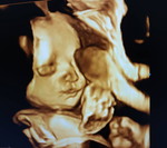 Som Siriporn profile icon