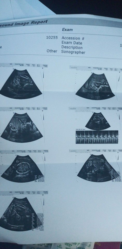 เตย profile icon