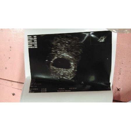 ต่อจากอันเดิม