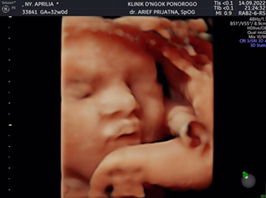 Afrillia dewi Setyarini profile icon