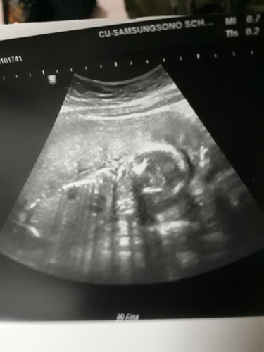 ช่วยดูหน่อยคะ ญ/ช