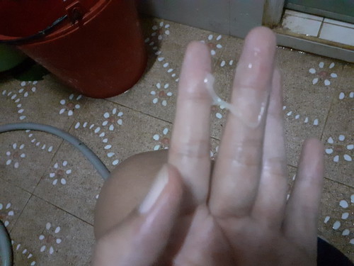 39weekกว่าแล้วมีมูกใสแบบนี้คือไรคะ