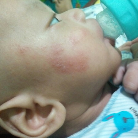 kulit bayi