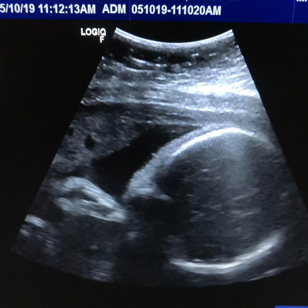 I Didn't Know I Was Pregnant.