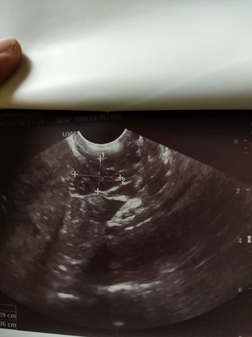 อิ แว้ profile icon