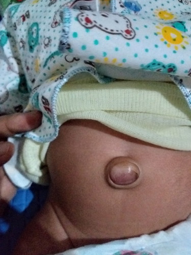 pusar bodong