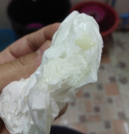 แบบนี้คือมูกมั้ยค่ะ +ท้องแข็ง