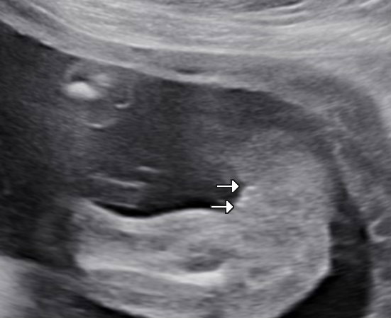 BOY OR GIRL?