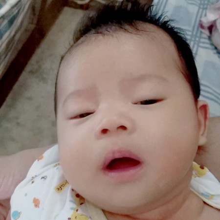 ดูดนมแล้วมีอาการเกร็งและเบ่ง