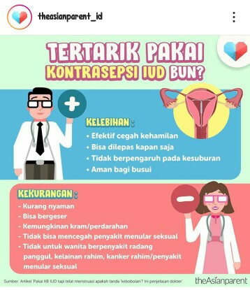 KB IUD