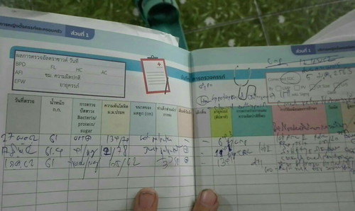 คือส่งสัย