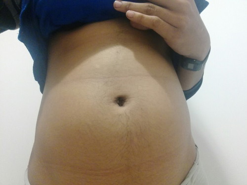 อยากรู้เพศเร็วๆจัง 17w