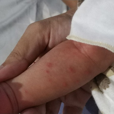 ini alergi atau apa ya?