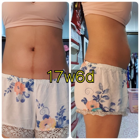 กังวลคะแม่ๆ คือแยกไม่ออกว่าอาการตอดเป็นยังไง