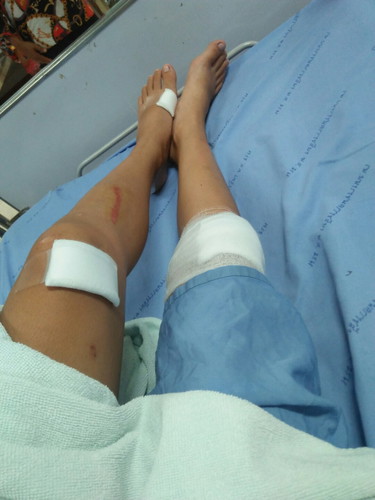 แชร์ประสบการณ์ขนเท้าลุก?