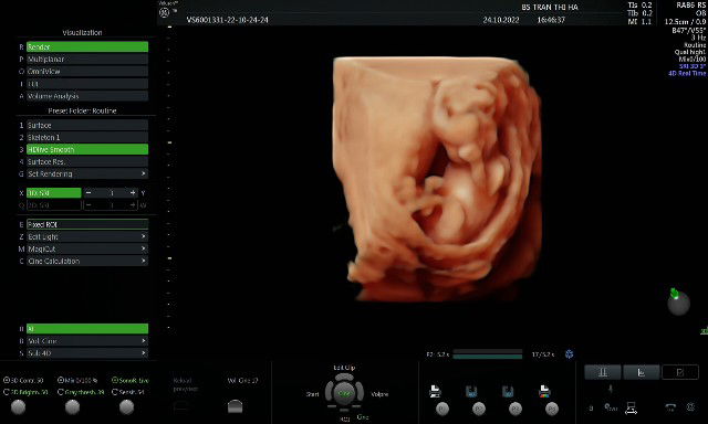 Mẹ bé Thom profile icon