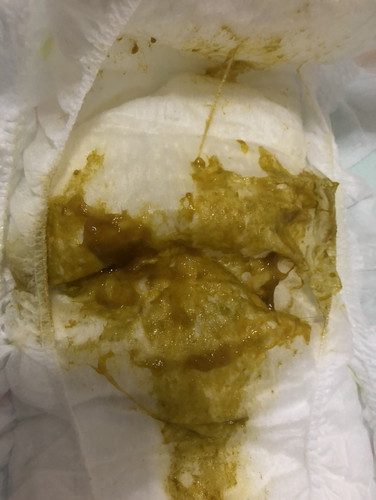 อึเป็นมูก