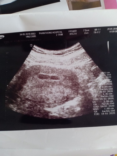 อยาบทราบอายุครรภ์